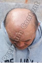 Head Hair Man White Casual Overweight Bald Street photo references